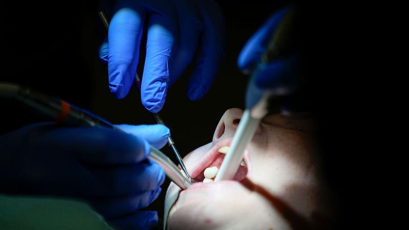  US dental care crisis: It should not be a luxury to keep your teeth in your mouth