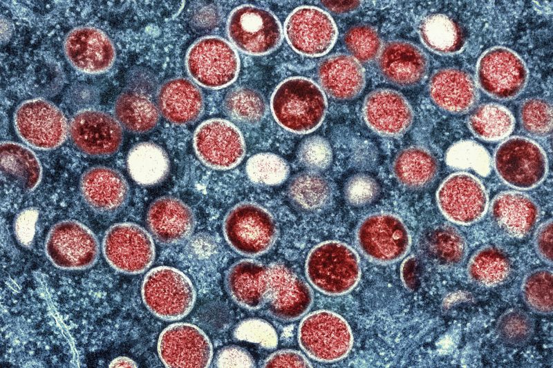  Sweden confirms first case of mpox