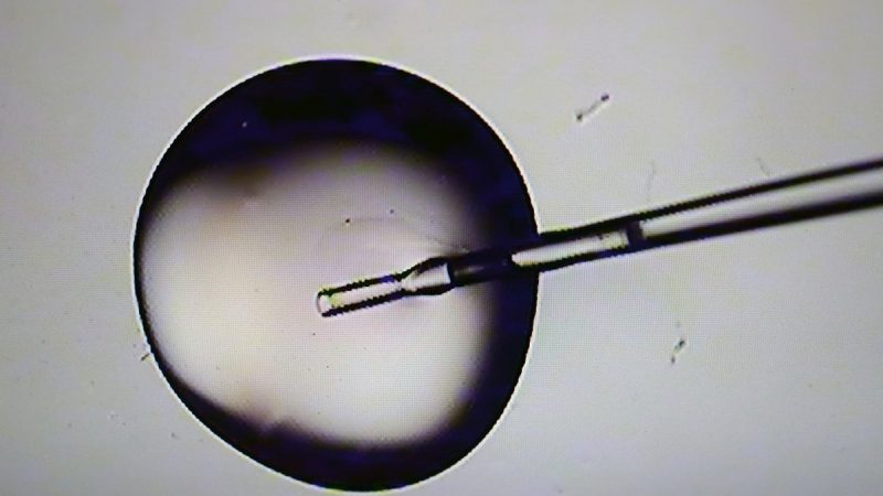  Republicans, pro-life advocates split on Trump’s proposal to federally subsidize IVF